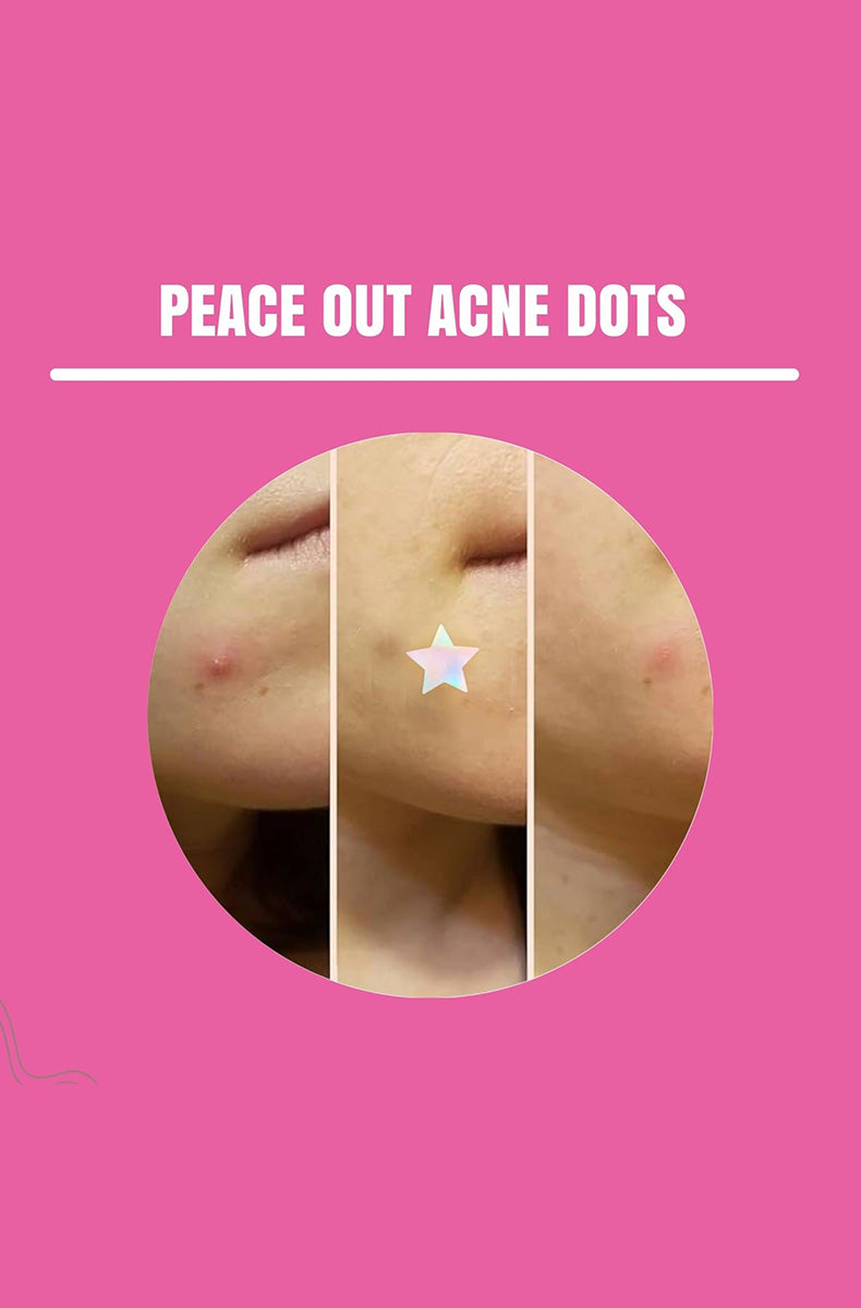 Direction card for Neva Nude SpotStix hydrocolloid acne patches showing application steps.